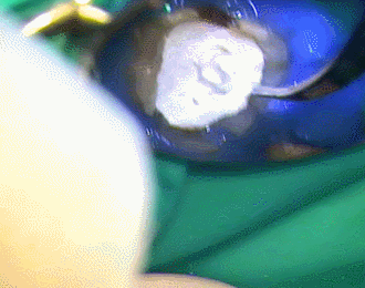 ストッピング仮封　2015.09.03.gif